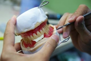 Prótesis dentales Blanqueamiento Dental en Clínica Dra. Olga Cabezuelo en Moriles Córdoba