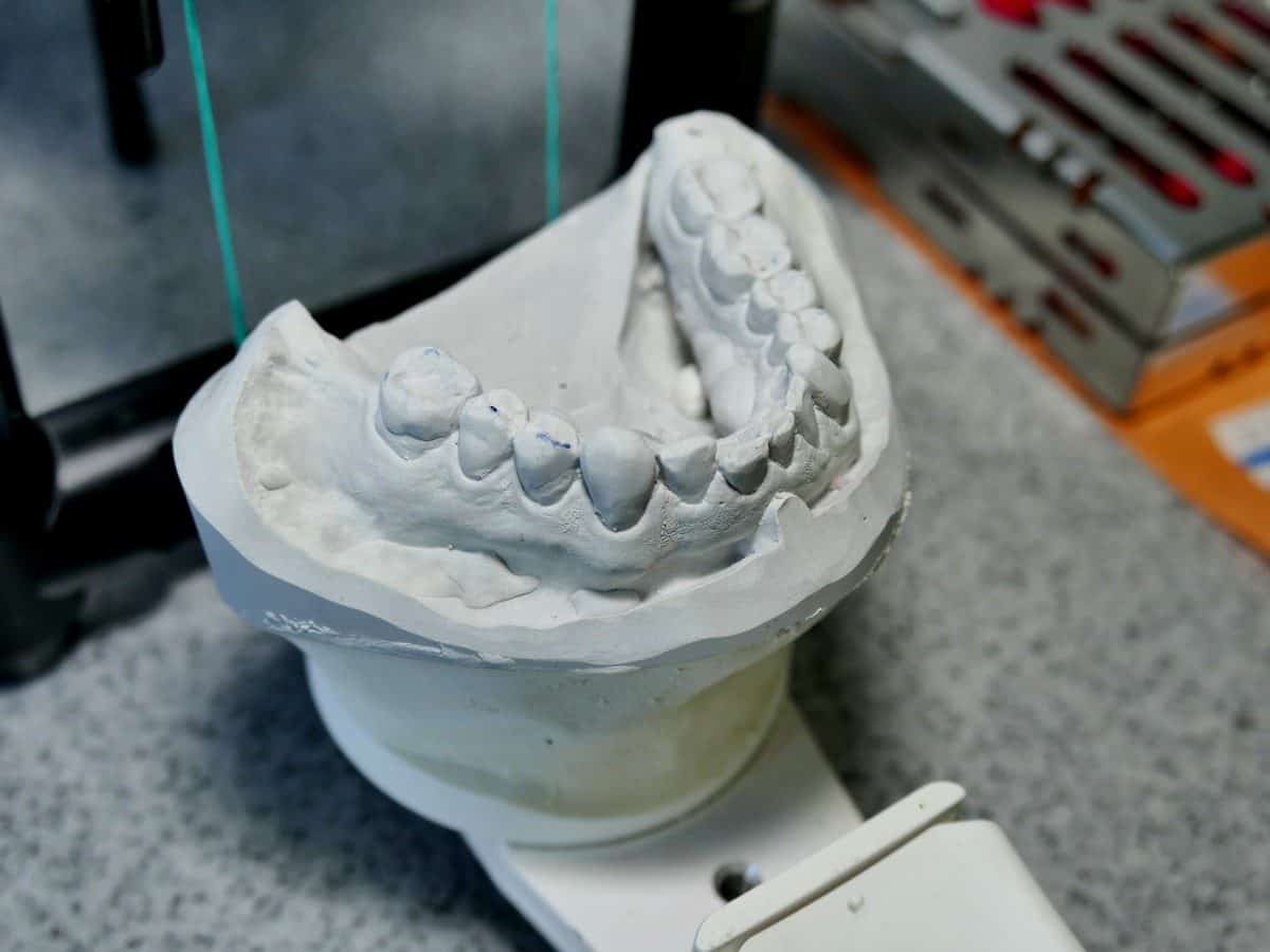 dental_model_pine_tooth_teeth-481041-1200x900.jpg