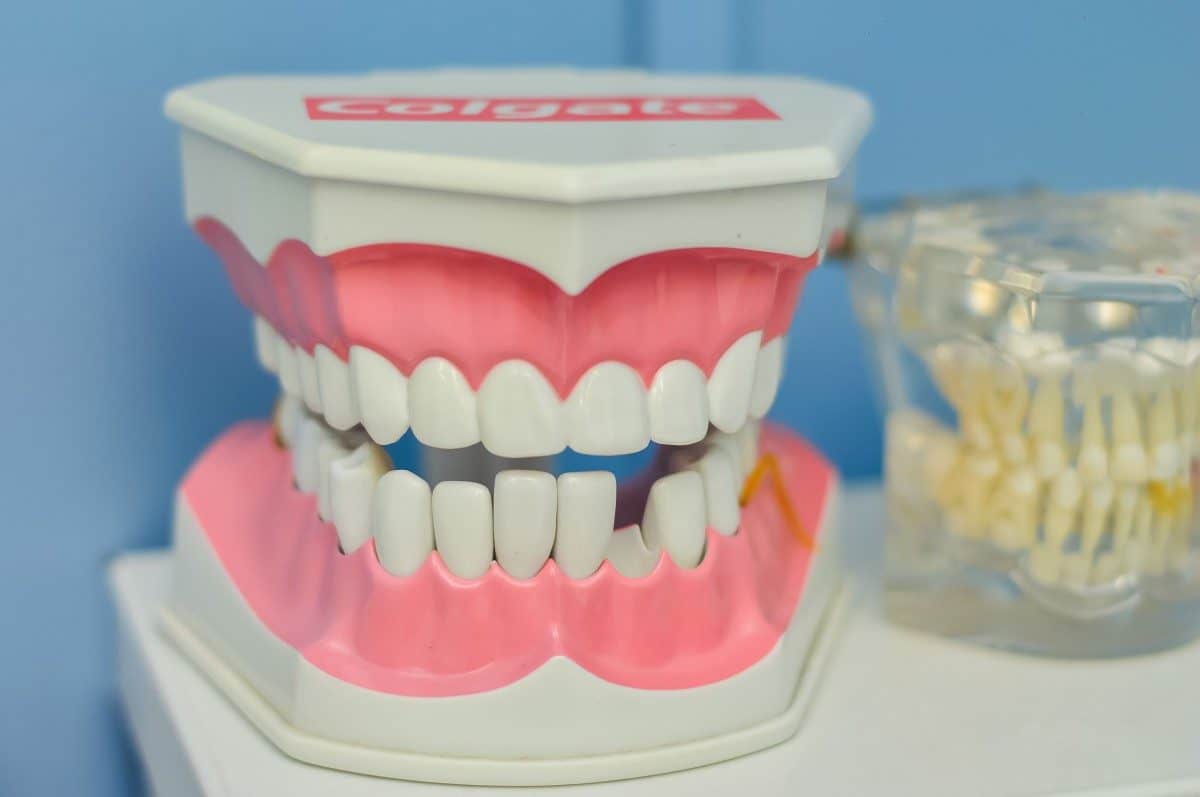 clinica-dental-olga-cabezuelo-implantes-dentales-1200x797.jpg