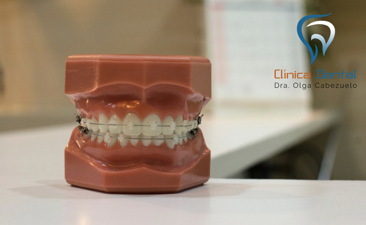 dentista-córdoba-ortodoncia-y-estética-dental-2-1200x739.jpg