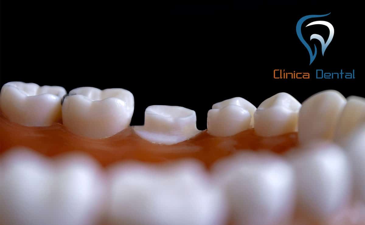 dentista-córdoba-ortodoncia-y-estética-dental-7-1200x739.jpg