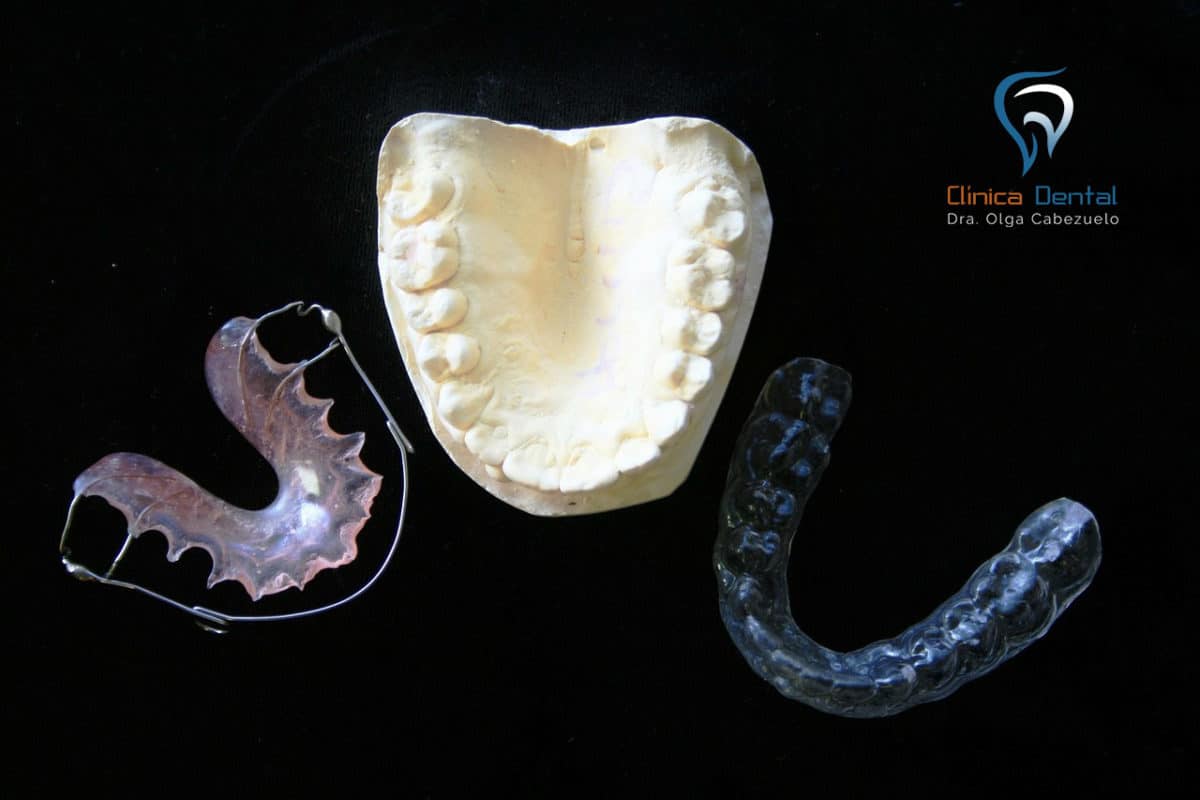 dentistacordoba-olga-cabezuelo-molde-dental-1200x800.jpg