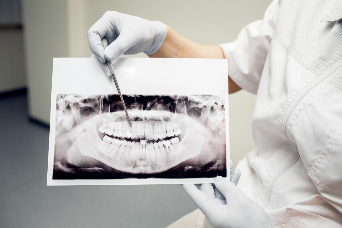 Dentista-Priego-de-Cordoba-Implantes-Dentales-1200x800.jpg